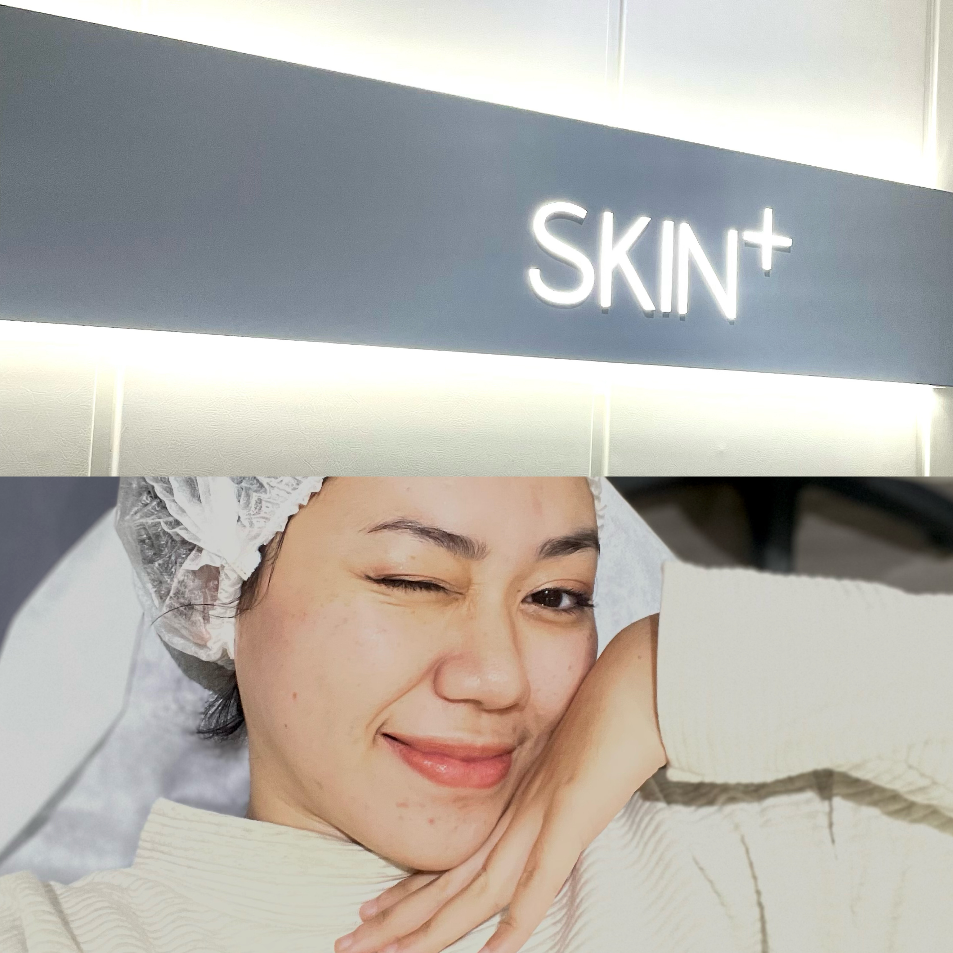 A New You Skin & Body Clinic A Perfect Treatment Combo: Maintenance Trilogy + Hydrawhite From SKIN+